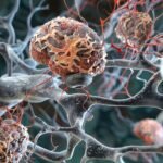 Medical illustration showing mechanical pressure inside a solid tumor and its effects on cancer cells